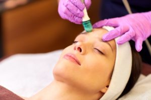 What is Microdermabrasion? featured image