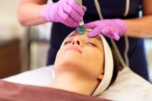 Microneedling for Acne Scars featured image
