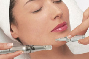 What is micro-needling? featured image