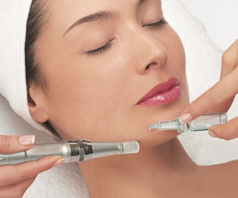 What is micro-needling? featured image
