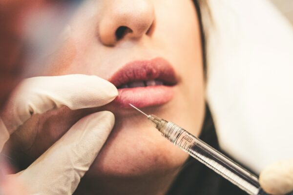 How does BOTOX Work featured image
